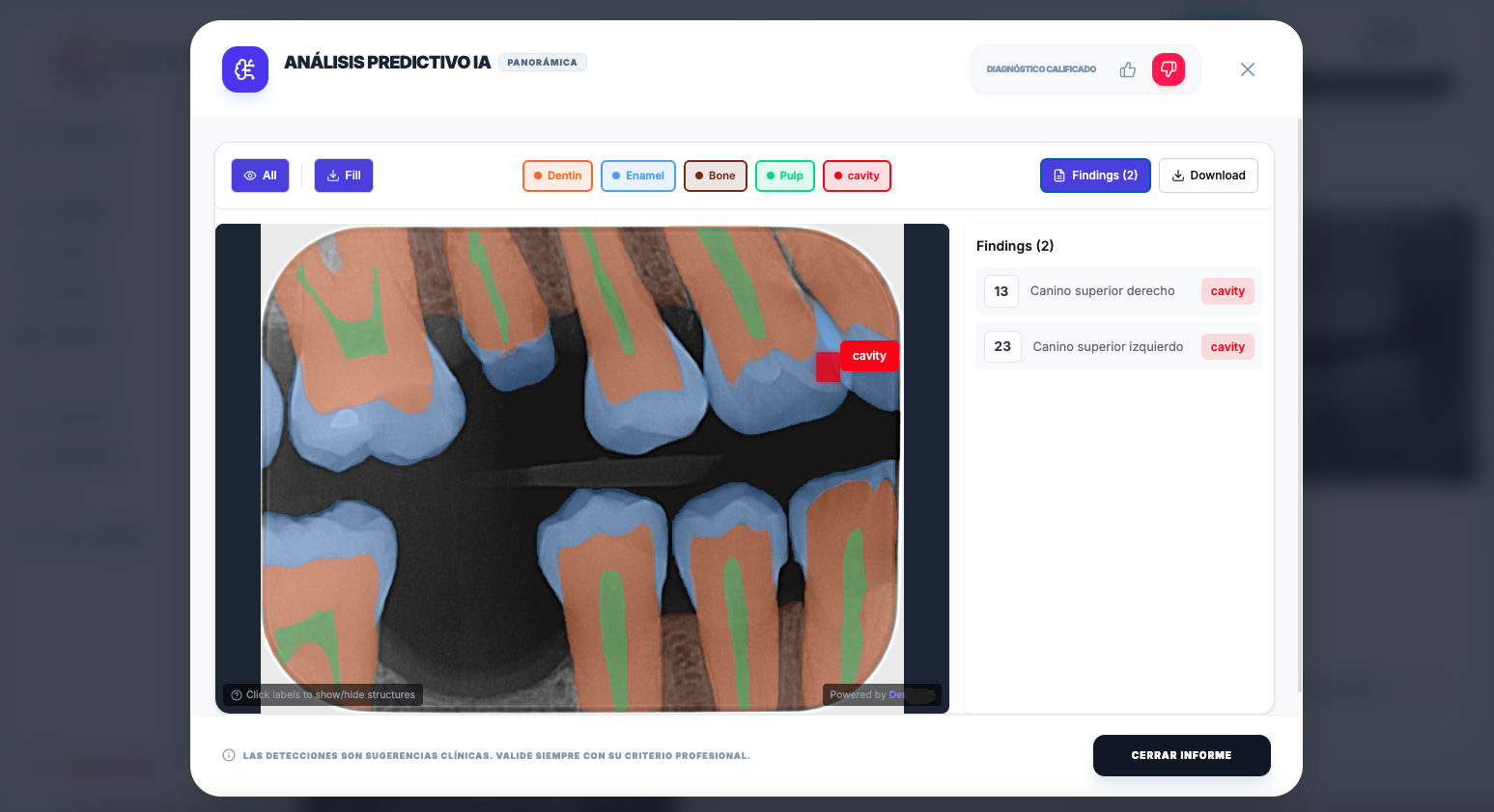 IA Predictiva RX